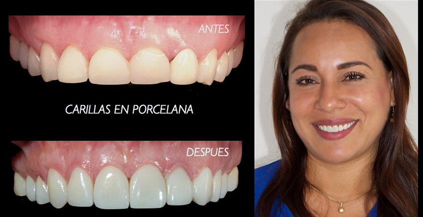 caso7